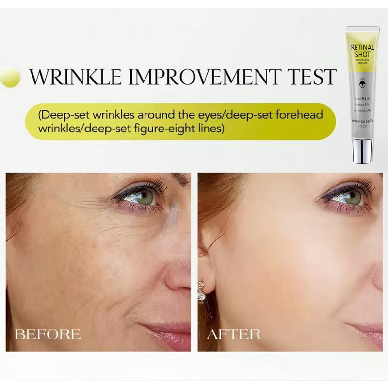 Retinal 0.1% Intensive Shot Pa - Retinol Anti Wrinkle Cream review and price