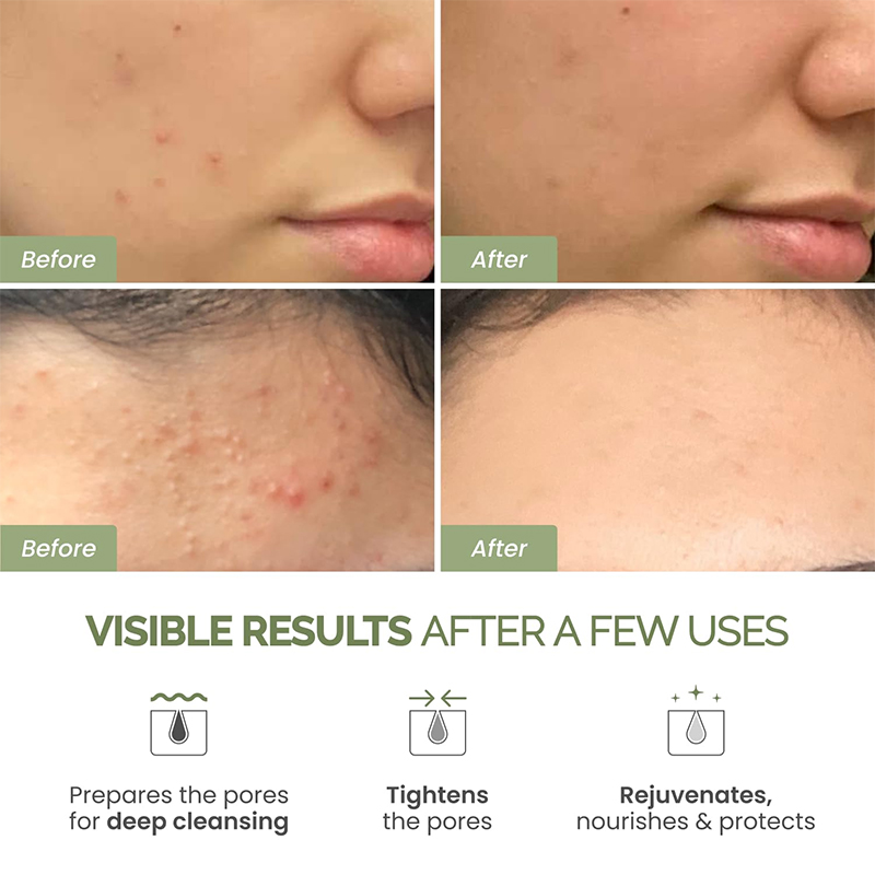Antioxidant Green Tea Clay Mas - Green Tea Cleansing Clay Mask review and price
