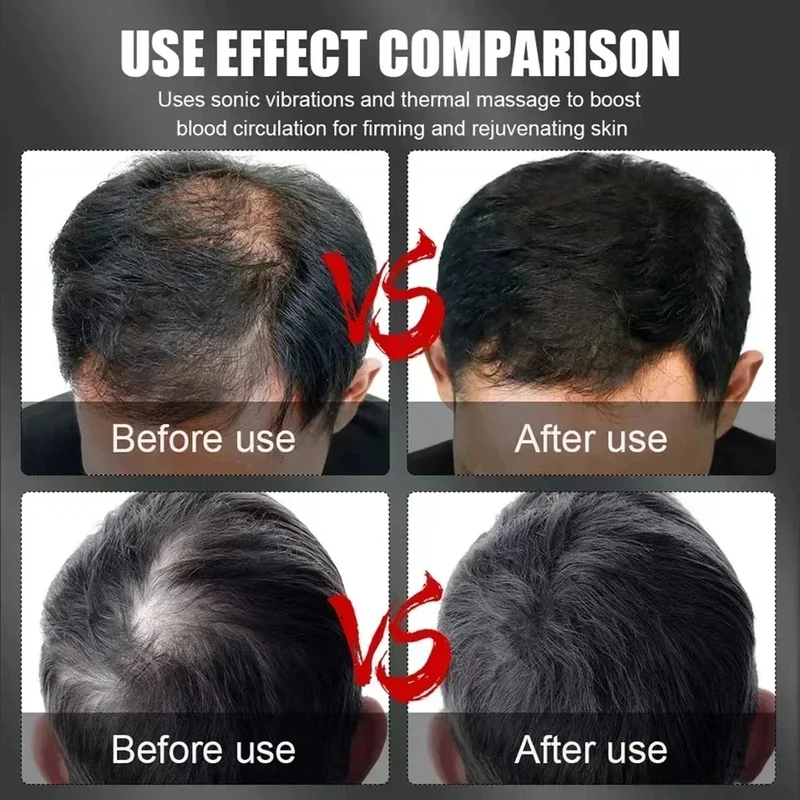 660nm 850nm Red Light Infrared - Hair Care review and price